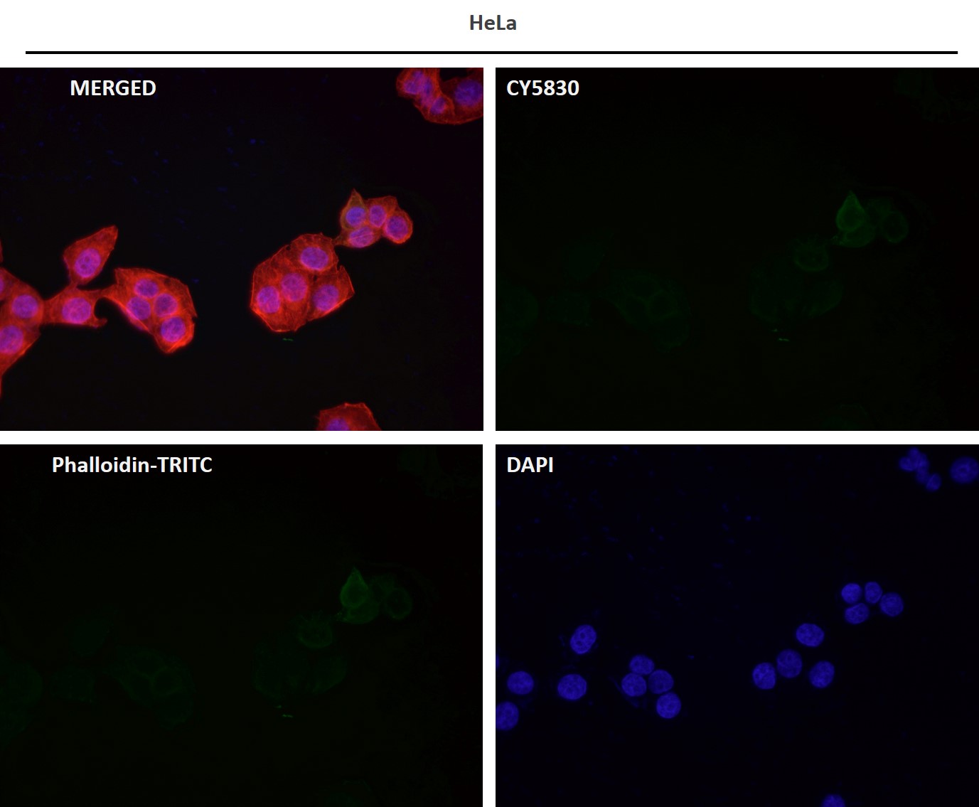 Rabbit Monoclonal to IRS1