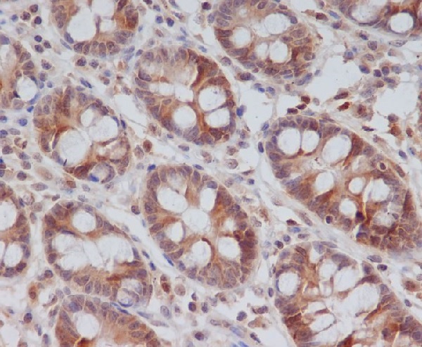 Rabbit Monoclonal to CyclinB2