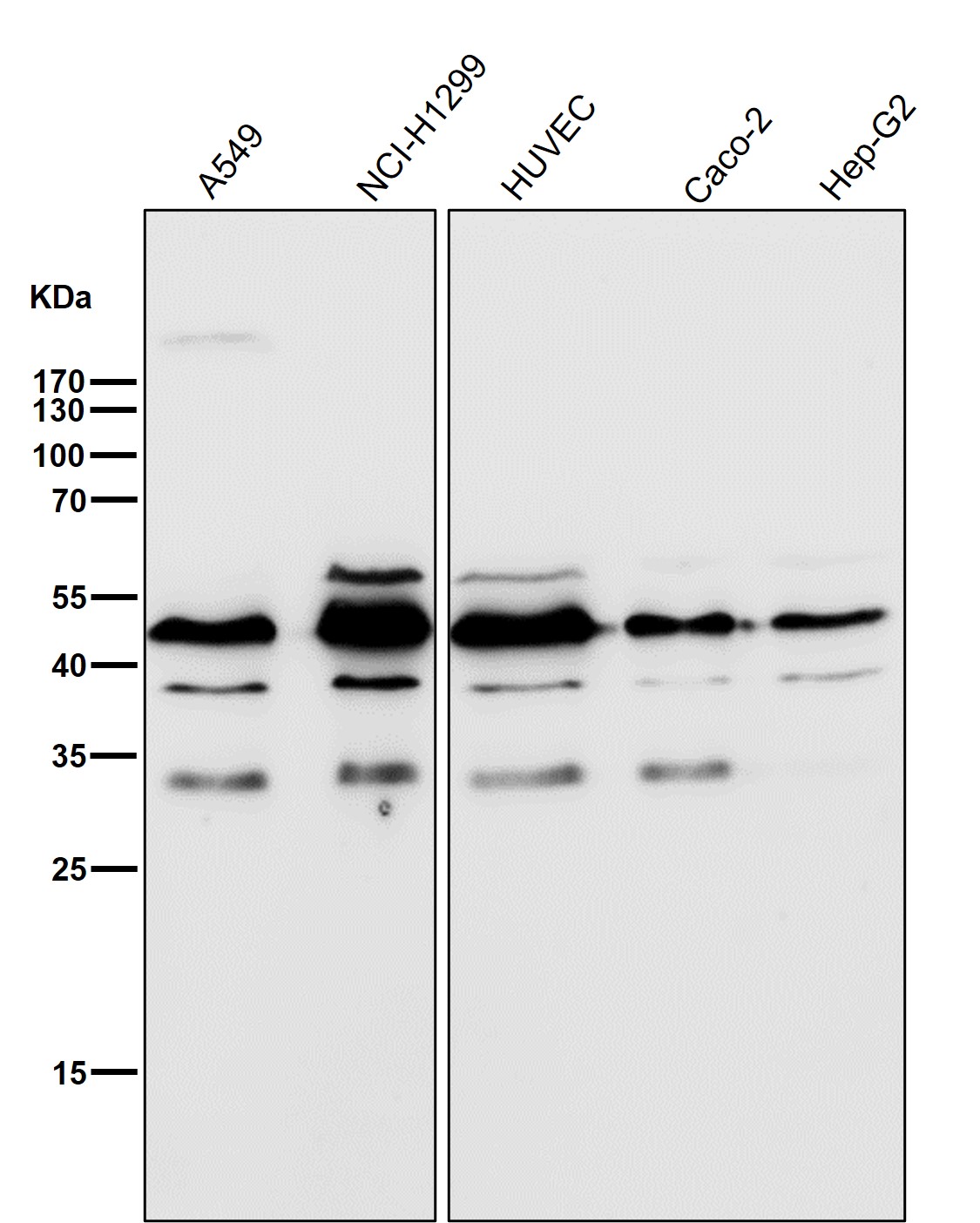 CyclinB2