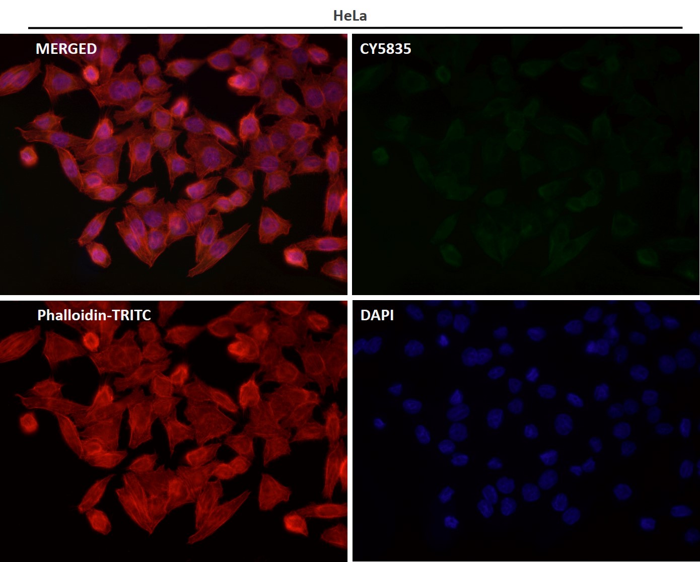 Rabbit Monoclonal to Cdk6