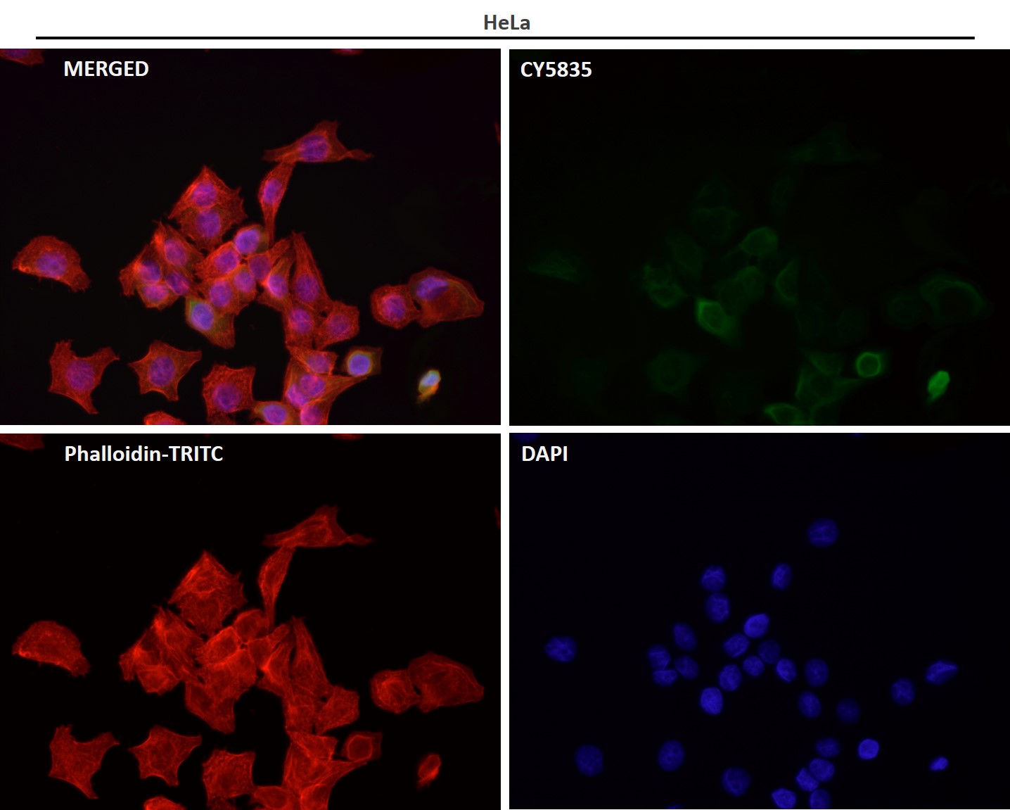 Rabbit Monoclonal to Cdk6
