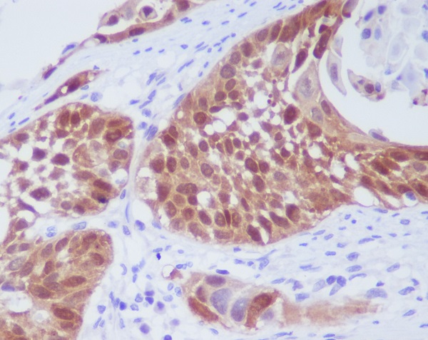 Rabbit Monoclonal to Cdk6
