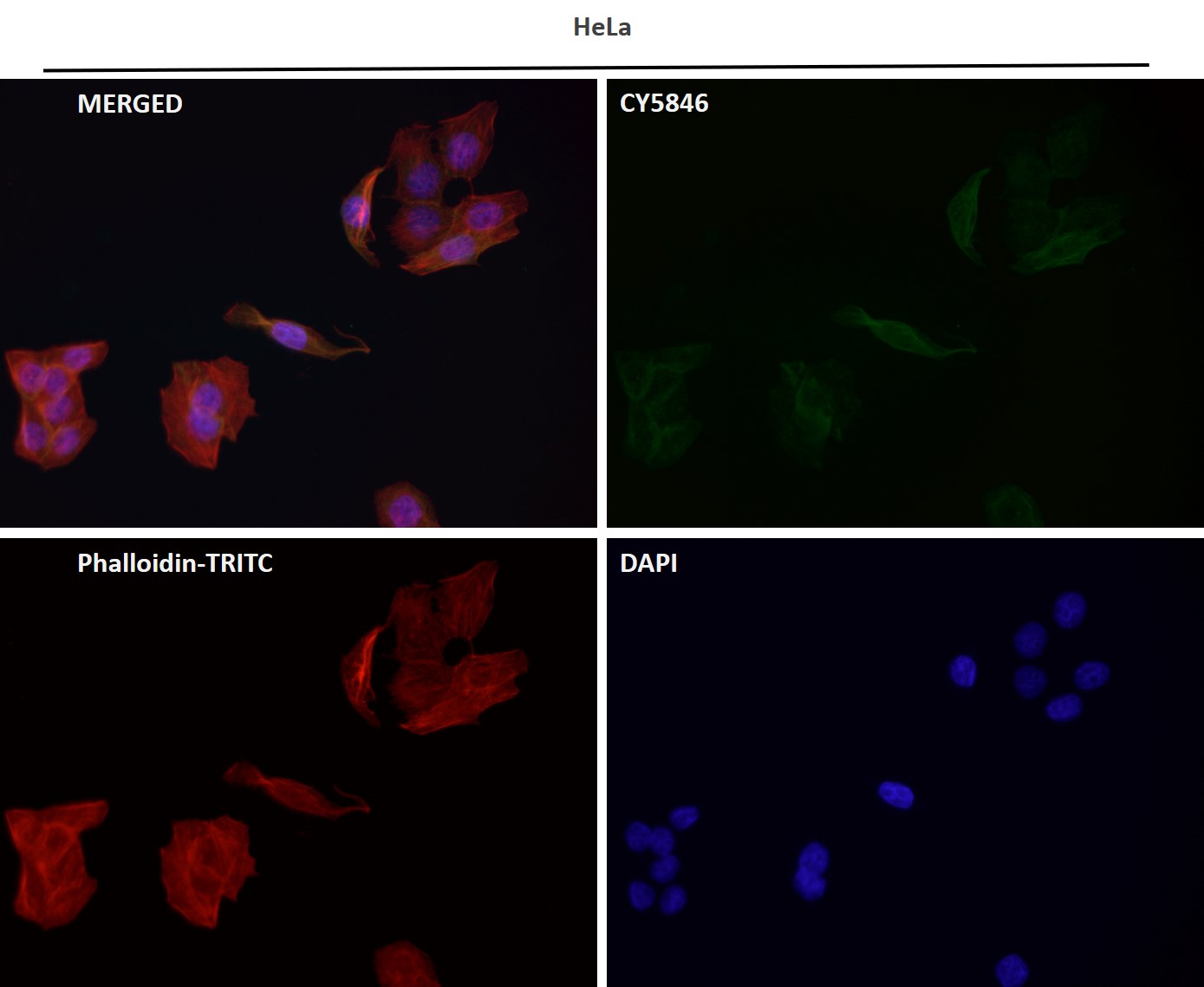 Rabbit Monoclonal to Tau