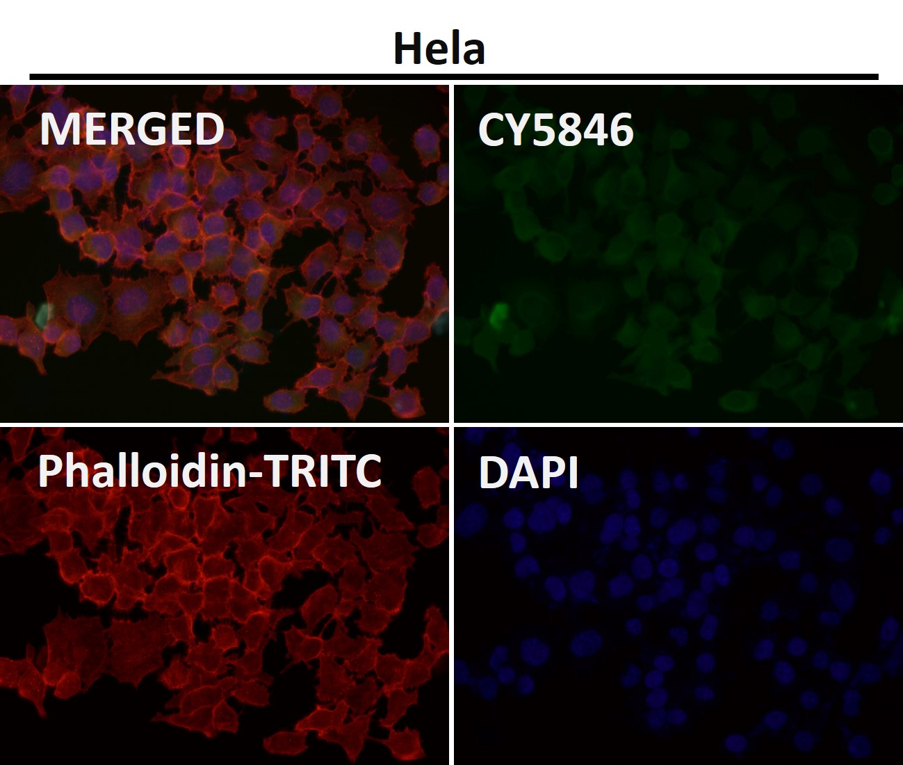 Rabbit Monoclonal to Tau
