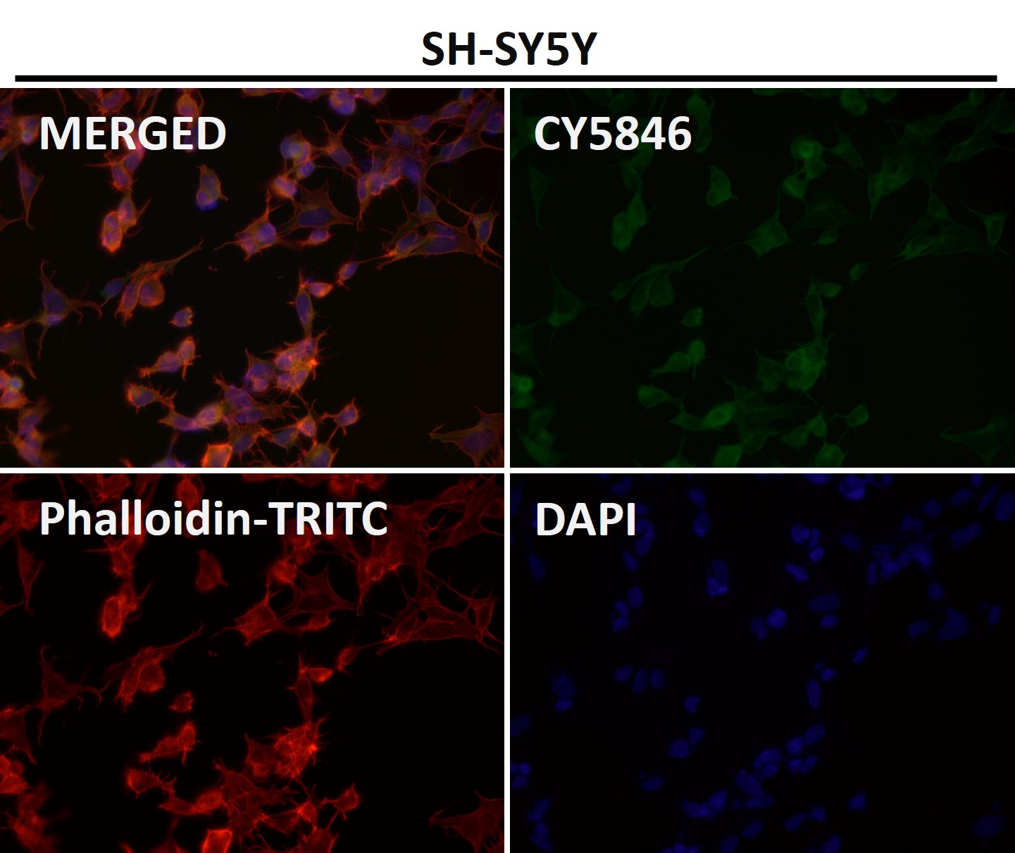 Rabbit Monoclonal to Tau