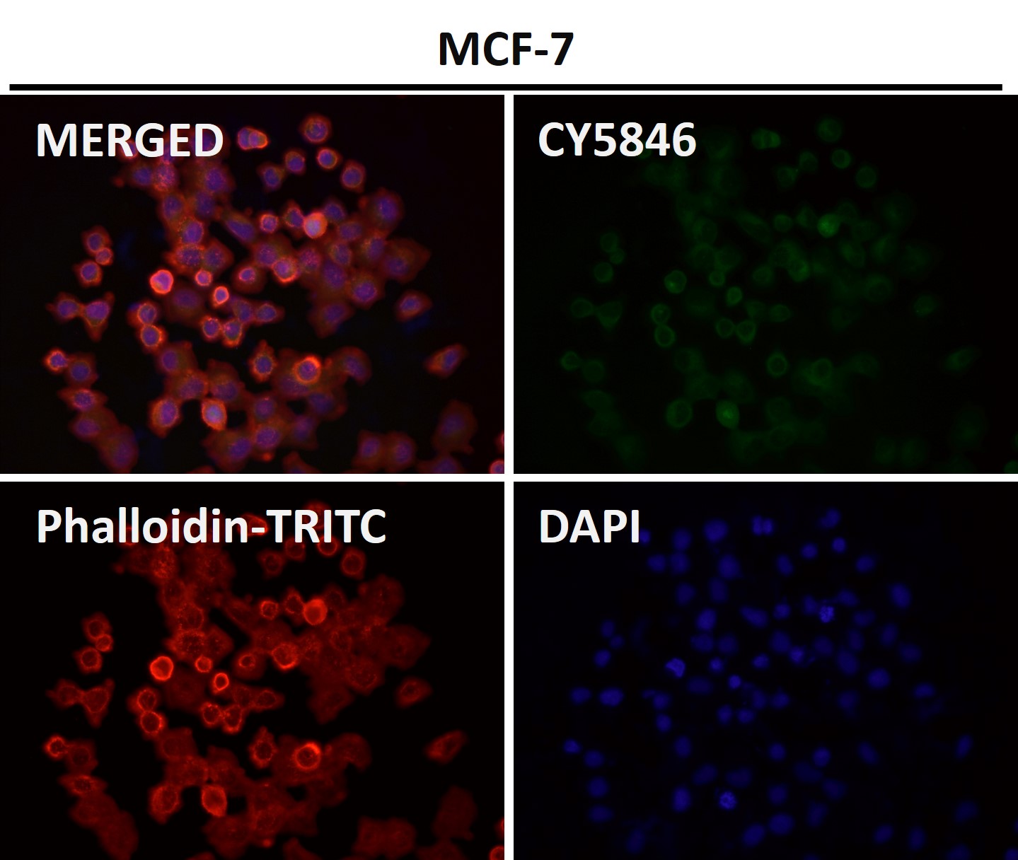 Rabbit Monoclonal to Tau