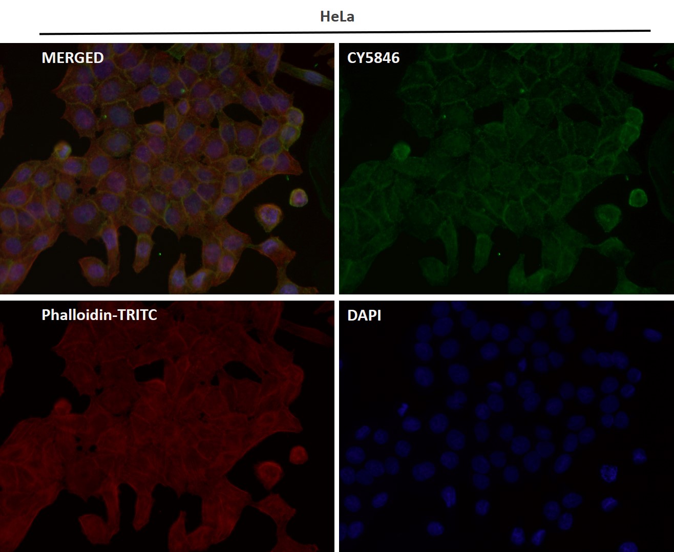 Rabbit Monoclonal to Tau