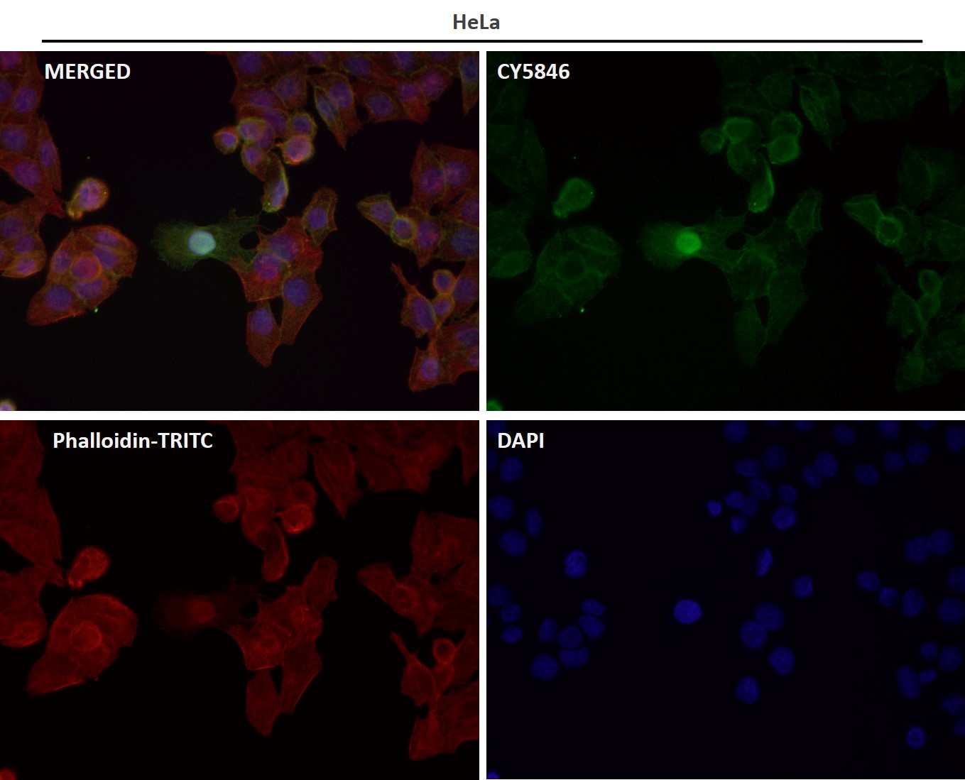 Rabbit Monoclonal to Tau