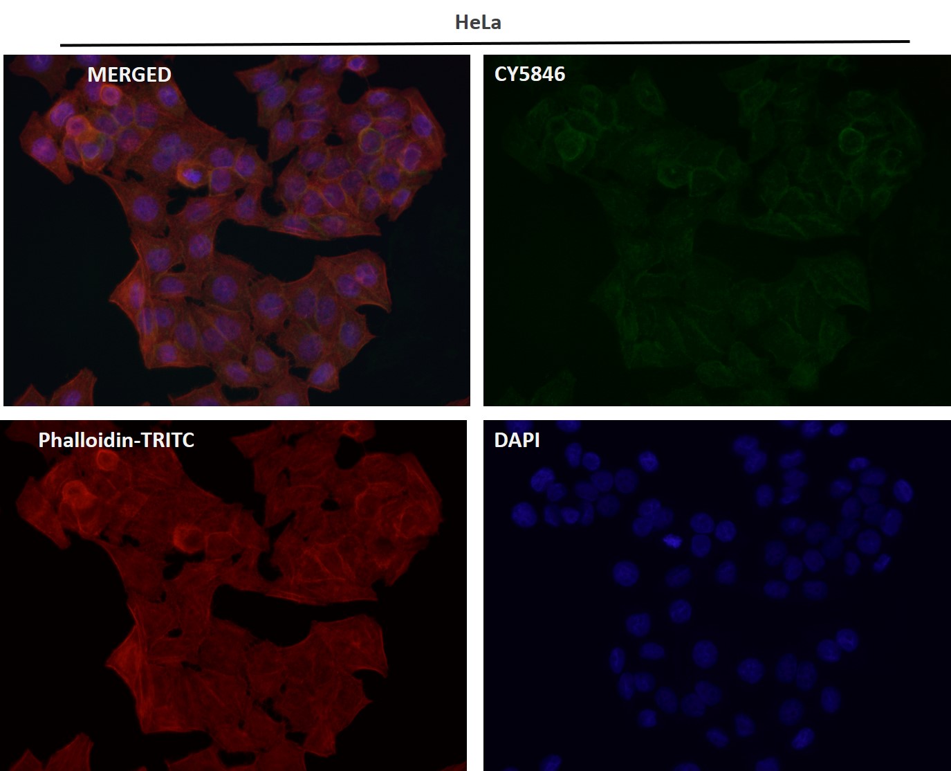 Rabbit Monoclonal to Tau