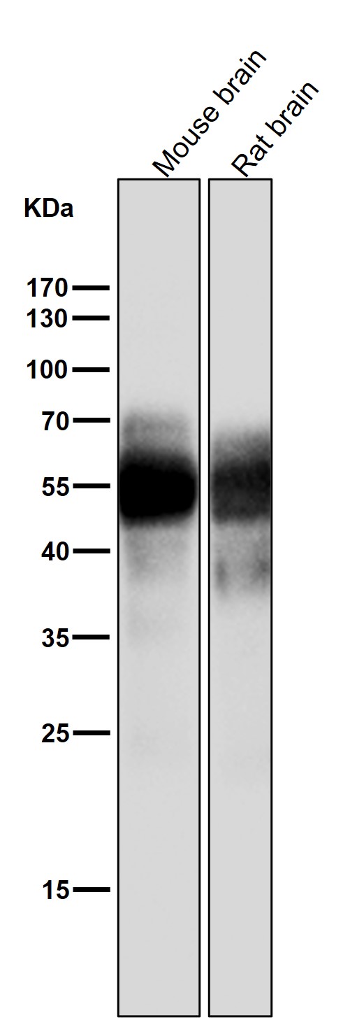 Rabbit Monoclonal to Tau