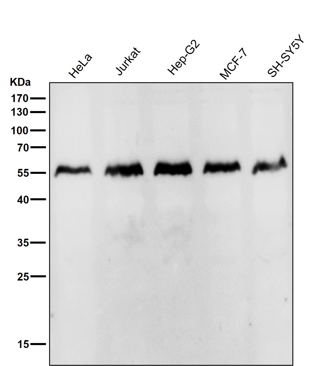 Rabbit Monoclonal to IRF2