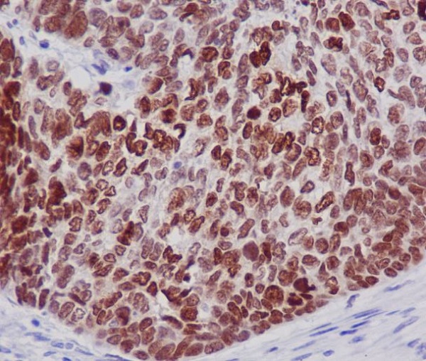 Rabbit Monoclonal to HistoneH2B
