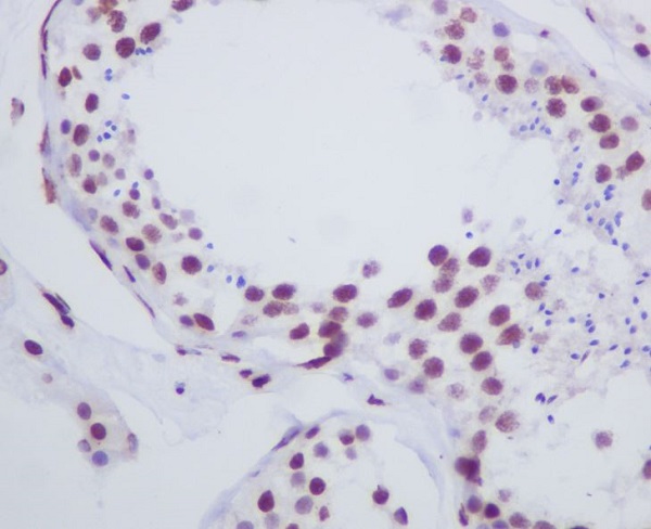 Rabbit Monoclonal to Histone H1.0