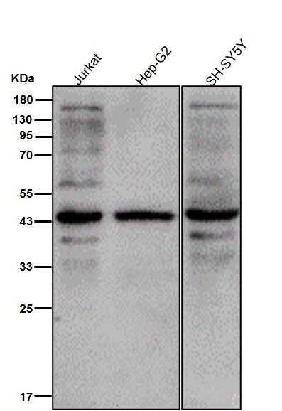 Rabbit Monoclonal to Phospho-MEK1(S298)