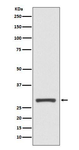 Rabbit Monoclonal to 14-3-3 sigma