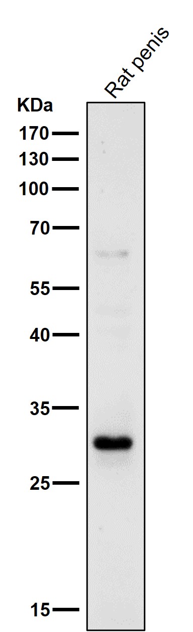 14-3-3 sigma