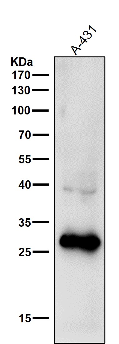 Rabbit Monoclonal to 14-3-3 sigma