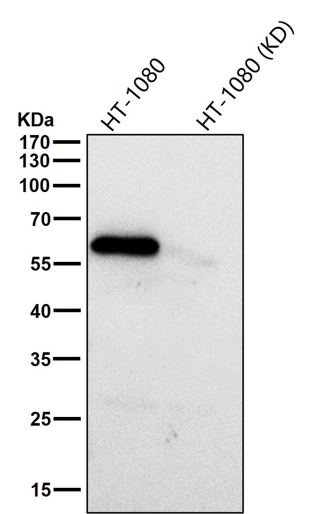 Rabbit Monoclonal to Phospho-Smad2(S250)