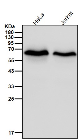 Rabbit Monoclonal to Phospho-Smad2(S250)