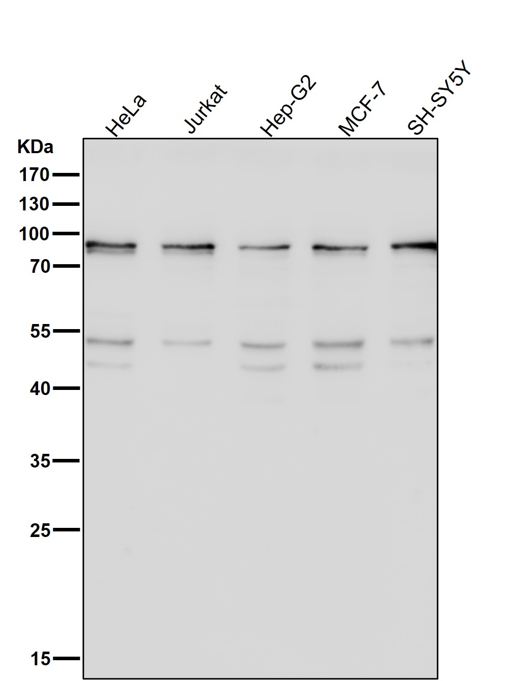 STAT1 alpha