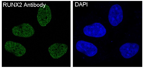 Rabbit Monoclonal to RUNX2