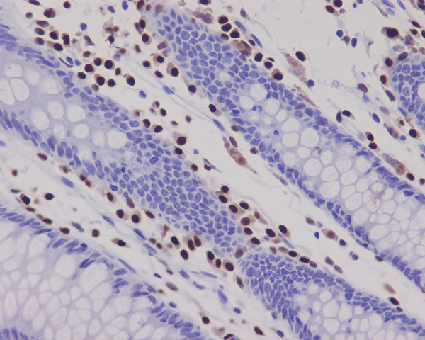 Rabbit Monoclonal to RUNX2