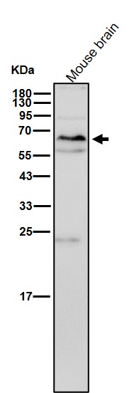 Rabbit Monoclonal to RUNX2