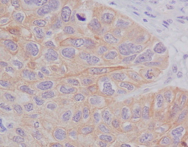 Rabbit Monoclonal to STAT2