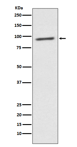 STAT2
