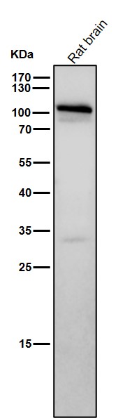 Rabbit Monoclonal to STAT2