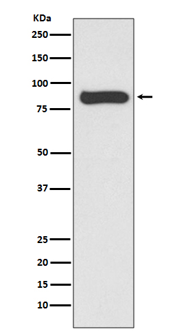 STAT4