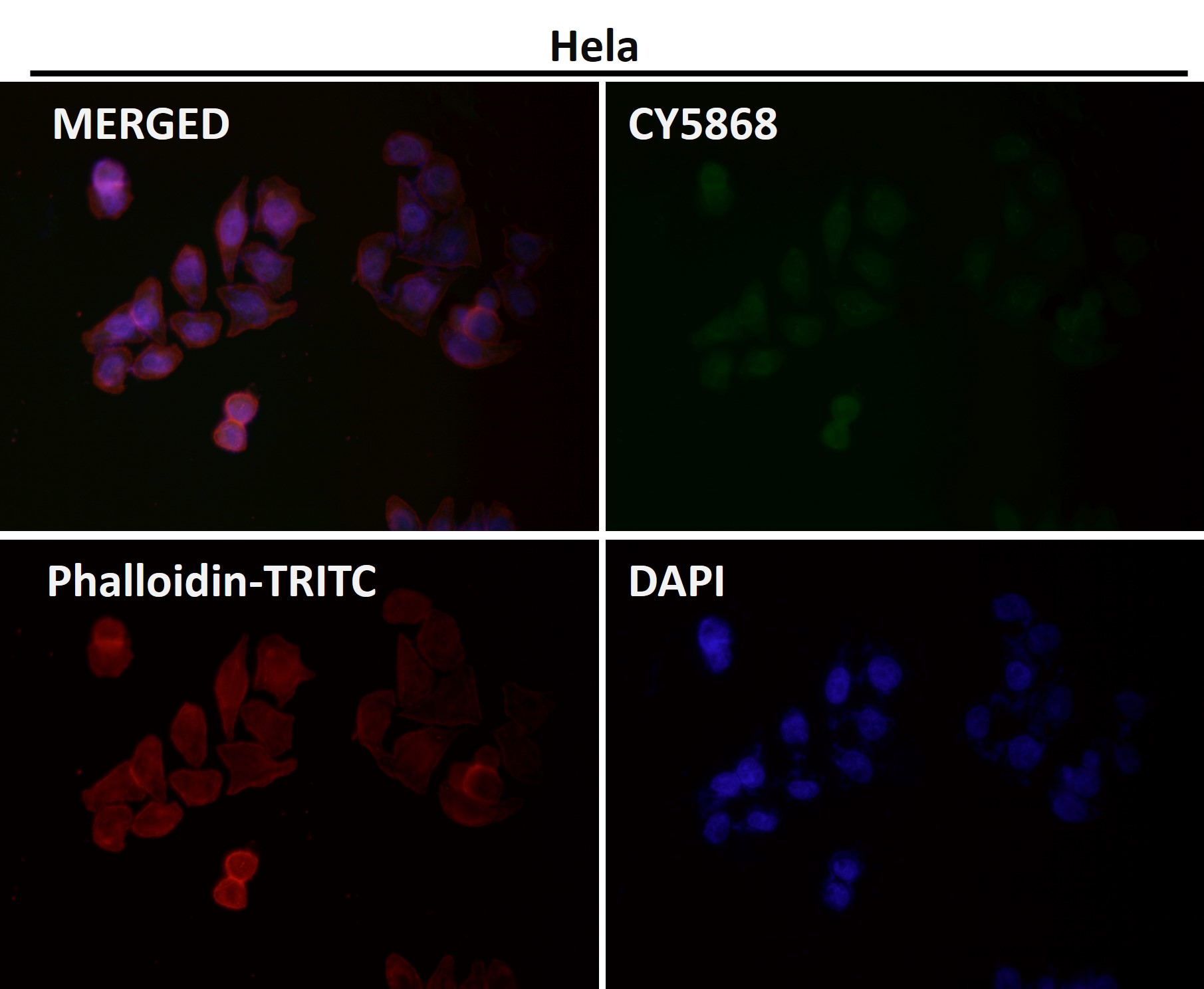 Rabbit Monoclonal to ERK5
