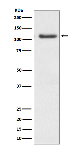Rabbit Monoclonal to ERK5