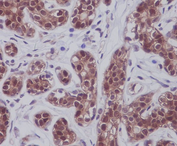 Rabbit Monoclonal to STAT5A/B