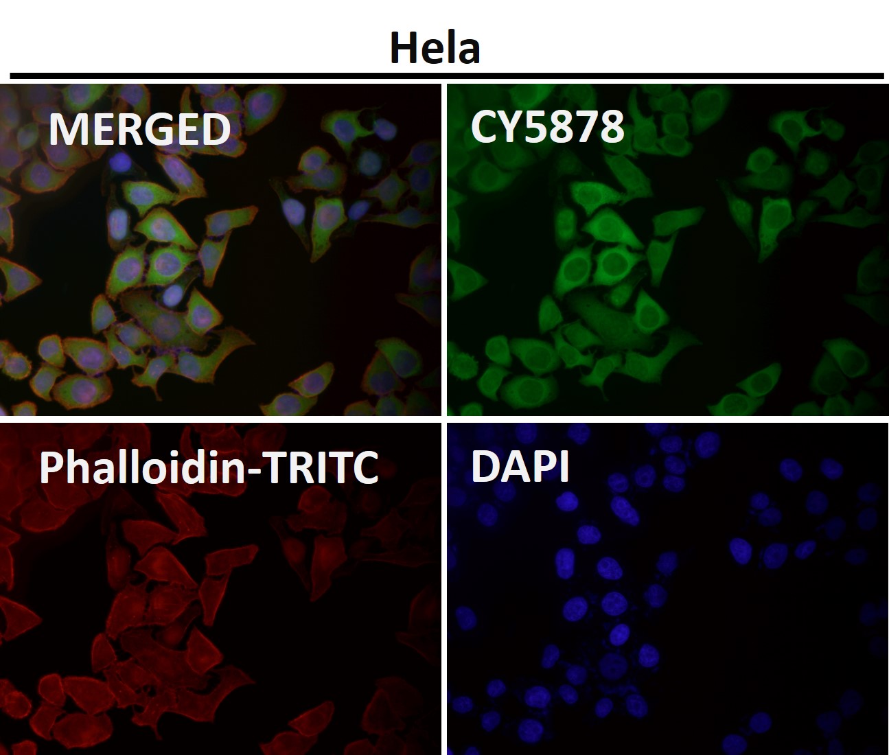 Rabbit Monoclonal to ATF5