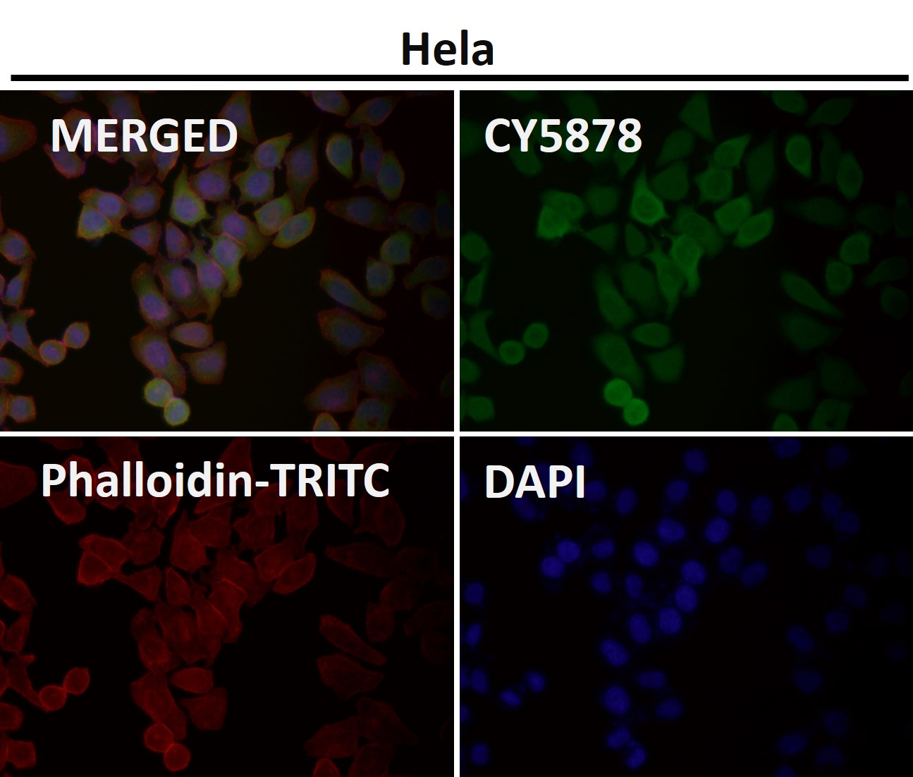 Rabbit Monoclonal to ATF5