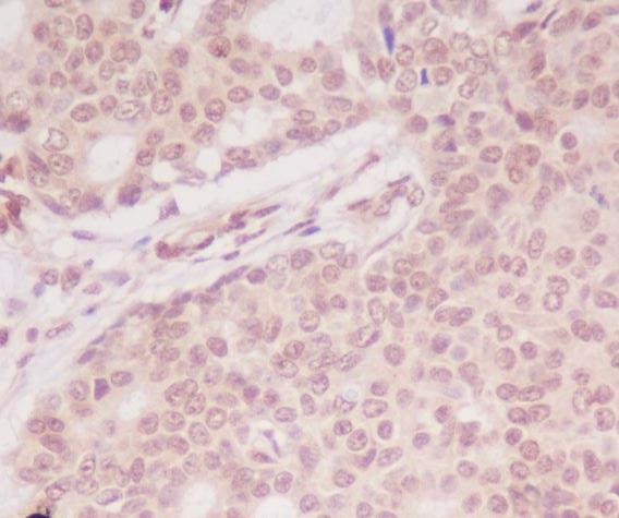Rabbit Monoclonal to ATF5
