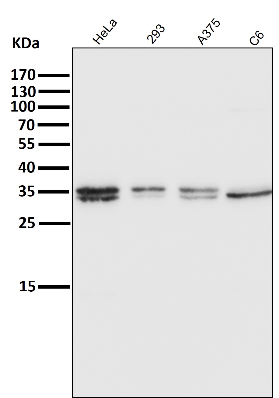 Rabbit Monoclonal to ATF5