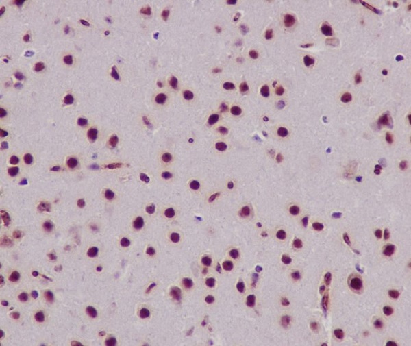 Rabbit Monoclonal to Histone H3