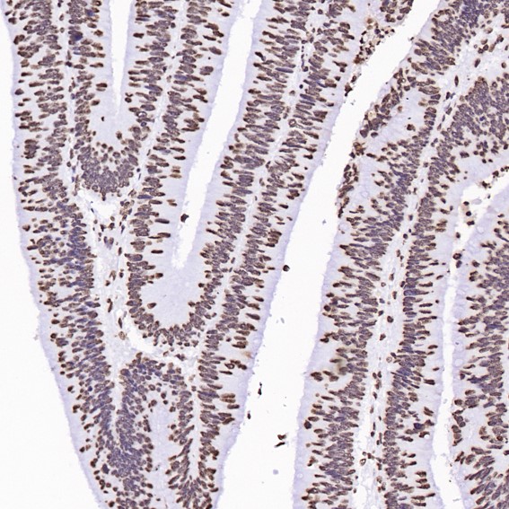 Rabbit Monoclonal to Histone H3