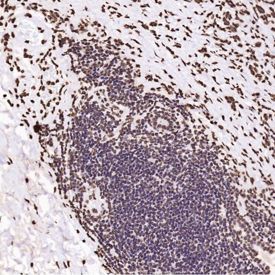Rabbit Monoclonal to Histone H3