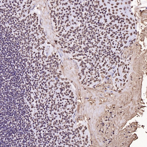 Rabbit Monoclonal to Histone H3