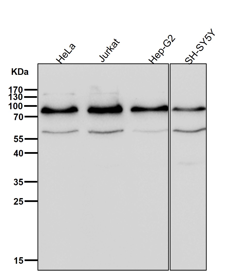 Rabbit Monoclonal to STIM1