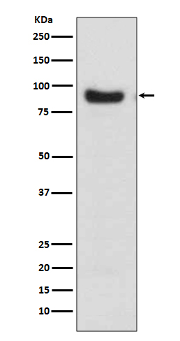 Rabbit Monoclonal to FOXO3A