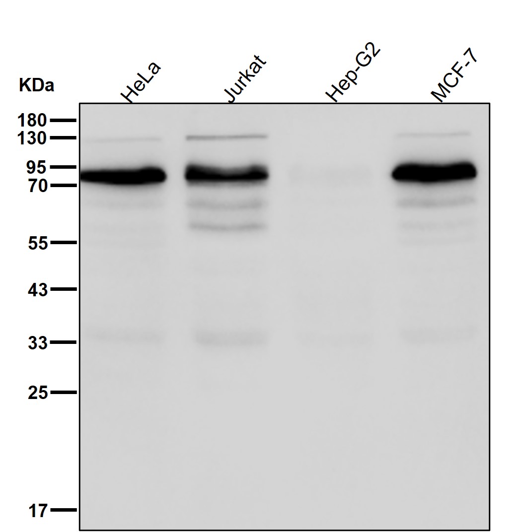 Rabbit Monoclonal to FOXO3A