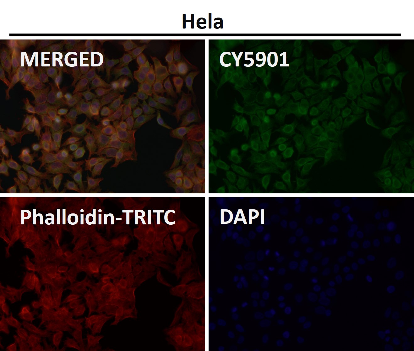 Rabbit Monoclonal to HDAC7