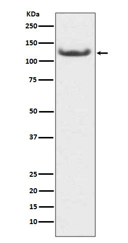 Rabbit Monoclonal to HDAC7