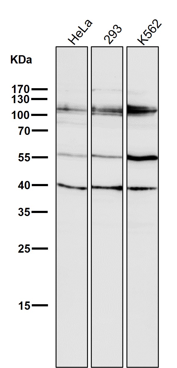 HDAC7