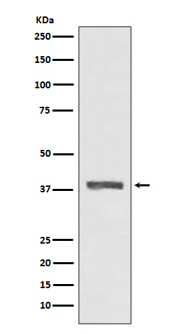 AMPK beta 1