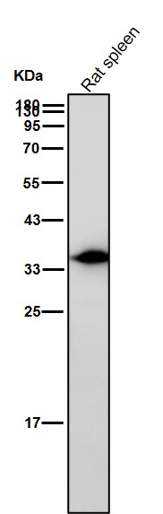 Rabbit Monoclonal to AMPK beta 1